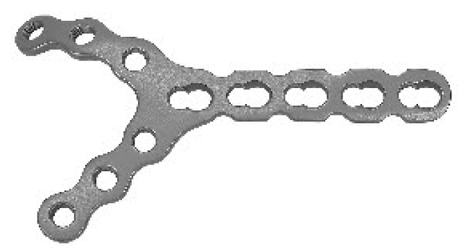 Дистальна плечева У-подібна блокуюча пластина UMP